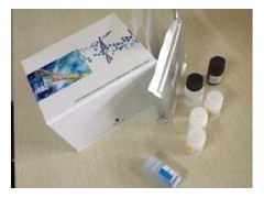 CPSA试剂盒,人复合前列腺特异性抗原ELISA试剂盒