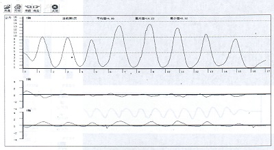 推拿手法参数测定仪