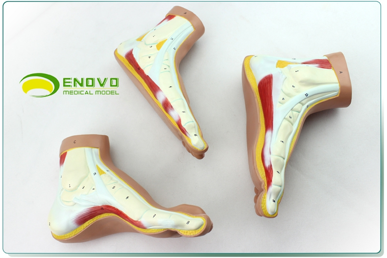 enovo颐诺医学正常足扁平足弓形足高弓足模型脚足弓模型运动系统